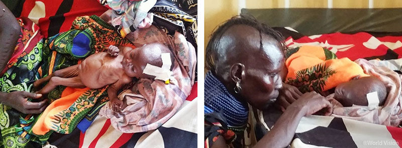  투르카나 전역에 드리워진 어두운 그림자는 어린 생명까지 위협하고 있었다.