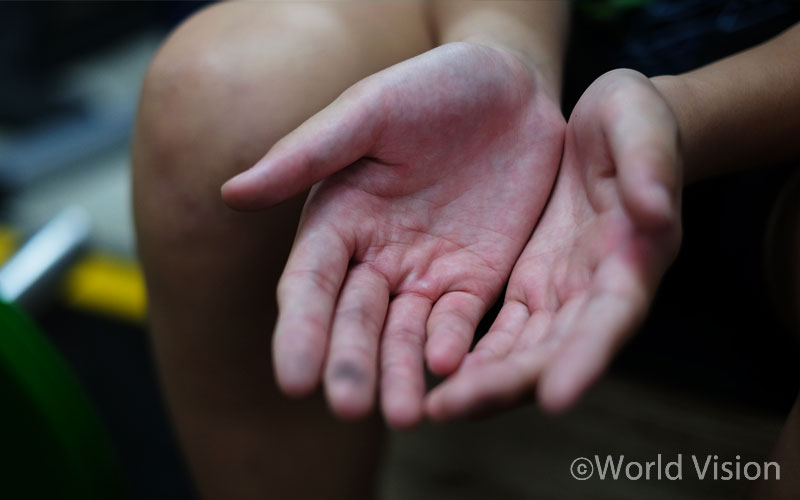 굳은 살이 박힌 승훈이의 손